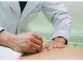 中医针灸培训，易颜特效针灸治疗妇科乳腺增生痛经针法